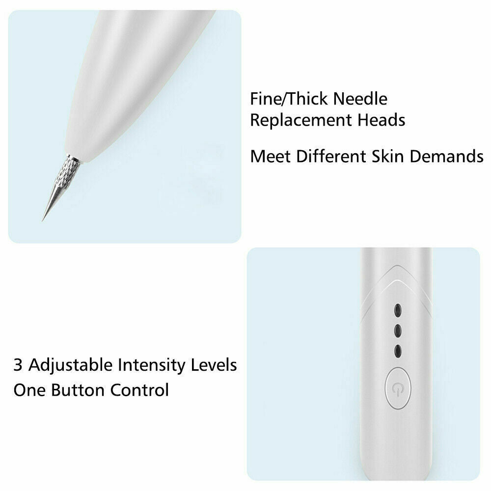 Ion Laser Freckle Skin Mole Dark Spot Remover Face Wart Tag Tattoo Removal Pen