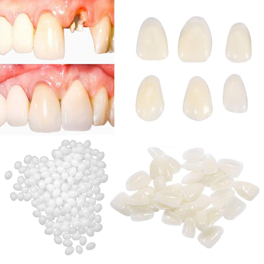 Brige Temporary Tooth Repair kit for Fix Filling the Missing Broken Tooth and Gaps-Moldable Fake Teeth Veneers and Thermal Beads Replacement Kit,Artfifical Teeth | Decor Gifts and More